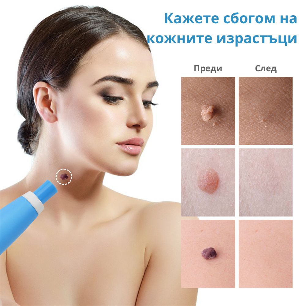 TagClean™ set za kožu – Uklonite kožne izdanke brzo i jednostavno.