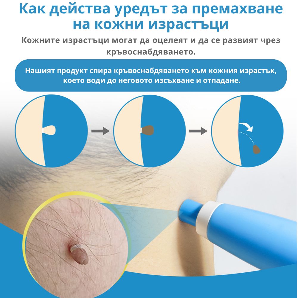TagClean™ set za kožu – Uklonite kožne izdanke brzo i jednostavno.